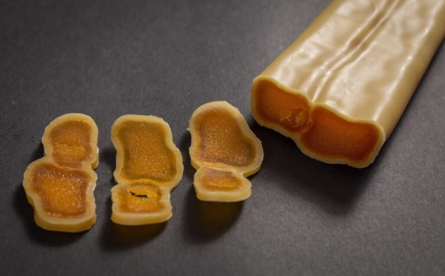 avgotaracho-mesologgi